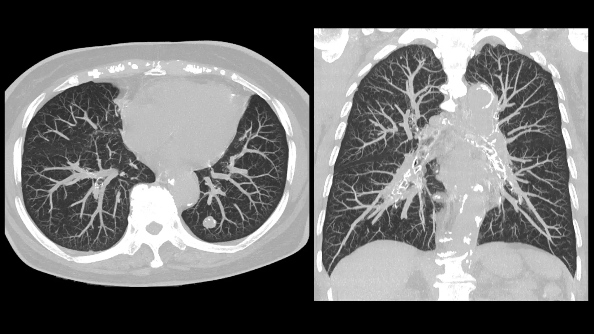 Sample Thorax CT Scan