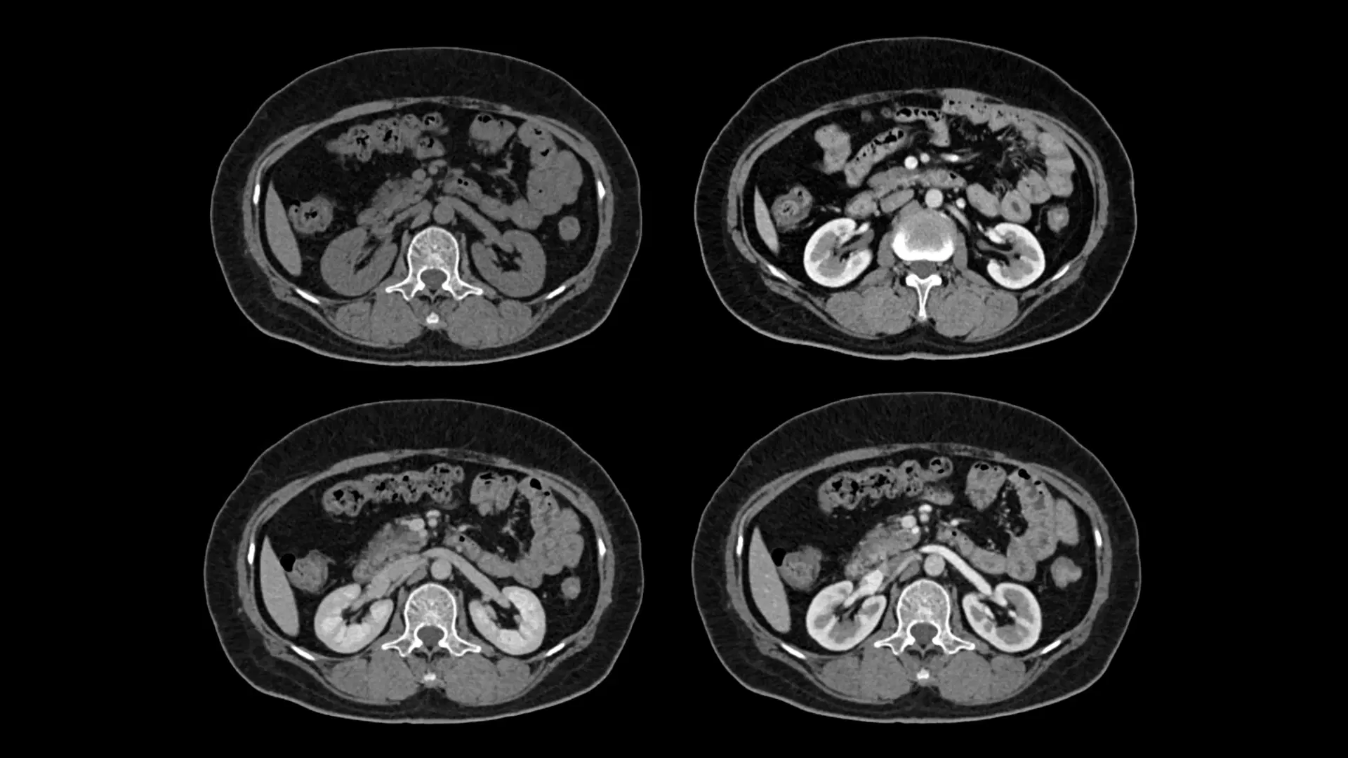 Sample Abdomen – multiphase imaging